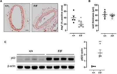 Defective Autophagy in Vascular Smooth Muscle Cells Alters Vascular Reactivity of the Mouse Femoral Artery